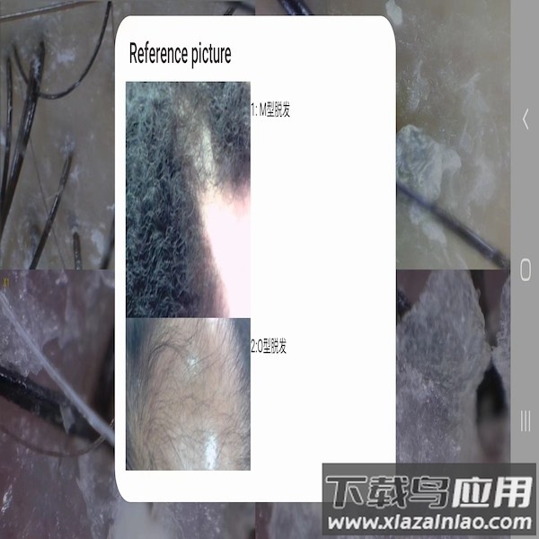 mrkv头皮检测软件 mrkv头皮检测app下载